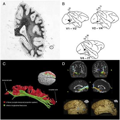 Functional Anatomy of the Inferior Longitudinal Fasciculus: From Historical Reports to Current Hypotheses